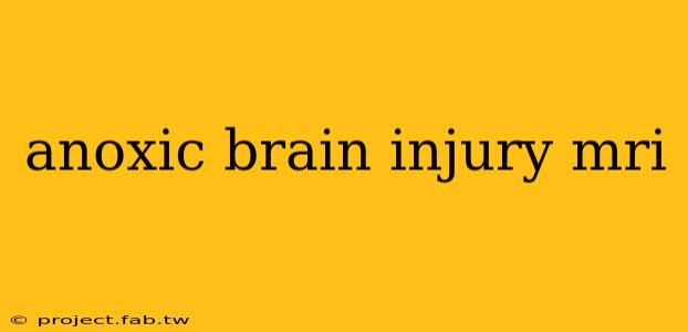 anoxic brain injury mri