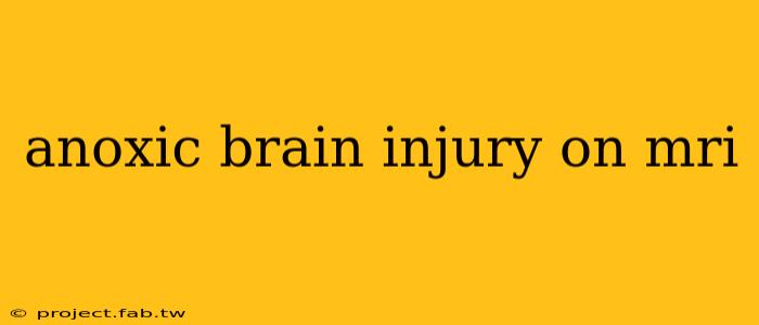 anoxic brain injury on mri