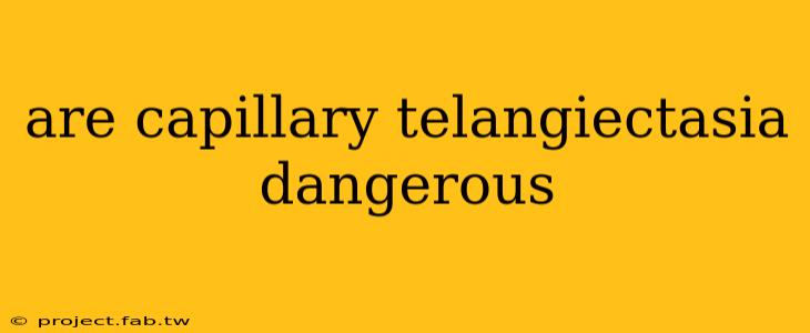 are capillary telangiectasia dangerous