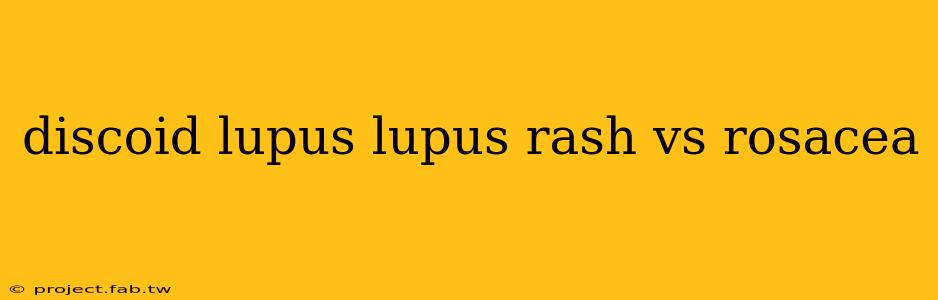 discoid lupus lupus rash vs rosacea