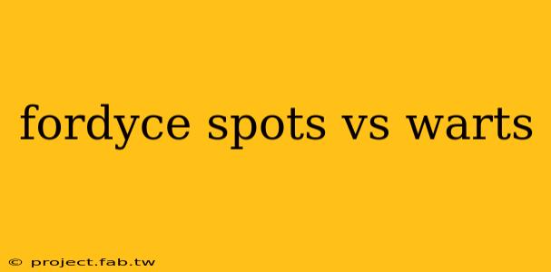 fordyce spots vs warts