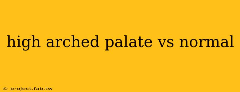 high arched palate vs normal