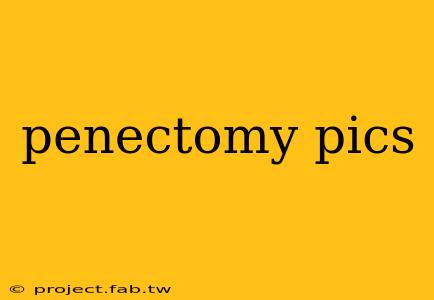 penectomy pics