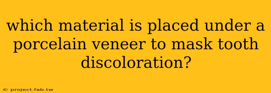 which material is placed under a porcelain veneer to mask tooth discoloration?